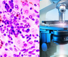 imagining technique ,fluorescence Optical bioimaging