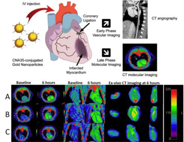 blood,injection,laboratory experience CT-based molecular imaging nanoparticle